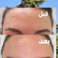 پوستتو با ما ترمیم کن|آرایشی، بهداشتی، درمانی|شیراز, ستارخان|دیوار