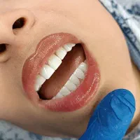 دندان پزشکی/دندانسازی/کامپوزیت/روکش/عصب کشی