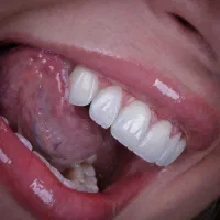 آموزش کاملا تضمینی کامپوزیت لبه شیشه ای