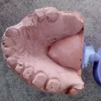 دندانسازی دست دندان