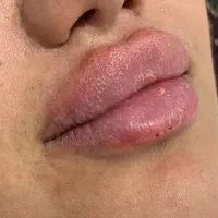 آف یلدایی ژل و بوتاکس|خدمات آرایشگری و زیبایی|دورود, |دیوار