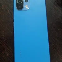 mi 11 light