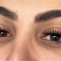 لیفت ابرو و مژه /کاشت مژه