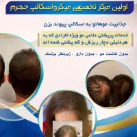 پرپشتی مو در سه روز بدون کاشتمو