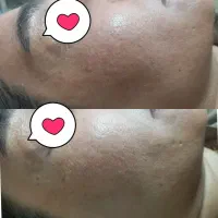 مرکز زیبایی نوژا (تخفیف پلاژن تراپی و میکروکارنت )|خدمات آرایشگری و زیبایی|جهرم, |دیوار