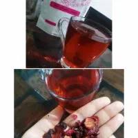 معجزه کبد چرب و داغی کف پا و خنکی بدن در این فصل