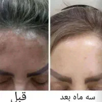 کرم معجزه  اصلی دستساز  متخصص تهران|آرایشی، بهداشتی، درمانی|کوهدشت, |دیوار