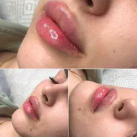 کلینیک لیزر و زیبایی دکتر سرمدی،،خدمات هدیه بگیرید|خدمات آرایشگری و زیبایی|اصفهان, هزارجریب|دیوار