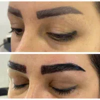 لابیاپلاستی/واژینوپلاستی/بوکال فت/ساکشن غبغب/کاشت|خدمات آرایشگری و زیبایی|تهران, فرمانیه|دیوار