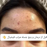 فیشیال وپاکسازی پوست ویژه بانوان|خدمات آرایشگری و زیبایی|سقز, |دیوار