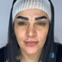 جشنواره تخفیفی میکروکاشت ابرو vip،کاشت مو،غبغب|خدمات زیبایی و سلامت|تهران, باغ فیض|دیوار