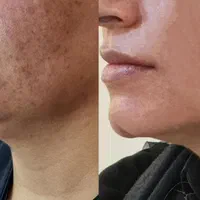کرم گلدن شاین سفید کننده و ضد لک پر قدرت اصل|آرایشی، بهداشتی، درمانی|شیراز, اصلاح‌نژاد|دیوار