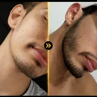 بالای ۷۰۰۰ نفر رضایت درمان
