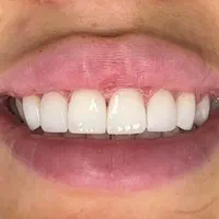 دندانپزشکی درمانی ایمپلنت زیبایی  با بهترین قیمت|خدمات آرایشگری و زیبایی|تهران, فلسطین (میدان انقلاب)|دیوار