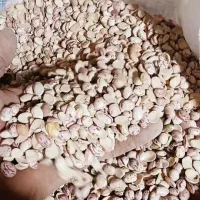 لوبیا چیتی سالم