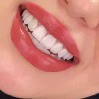 سفیدی واقعی دندان امروز باشرایط ویژه قابل رزروه