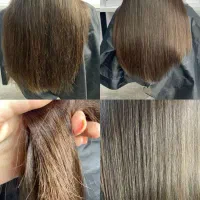 موخوره گیری با دستگاه