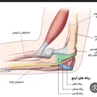 پارگی تاندون دست