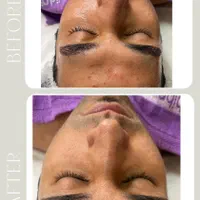 پاکسازی پوست صورت آقایان|خدمات آرایشگری و زیبایی|اصفهان, خلجا|دیوار