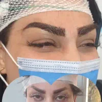 کاشت  تخصصی مو و ابرو