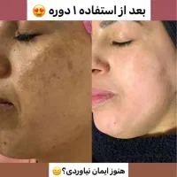 کرم ضدلک لاکچری کوین(کرم ۸ کاره)|آرایشی، بهداشتی، درمانی|شیراز, ملاصدرا|دیوار