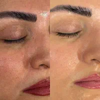 پاکسازی تخصصی پوست با دستگاه|خدمات آرایشگری و زیبایی|لاهیجان, امیرشهید|دیوار