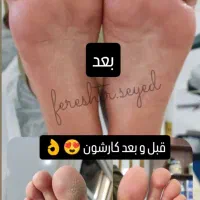 پدیکورتخصصی ،پنجشنبه ۱ آبان ،فقط۲۵۰۰|خدمات آموزشی|یزد, |دیوار