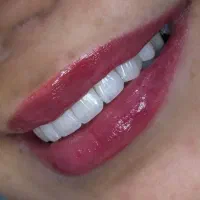 کامپوزیت تخفیف ویژه به مناسبت پاییز|خدمات آرایشگری و زیبایی|کرج, گوهردشت|دیوار