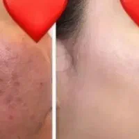 رفع پیسی گلوتاتون سفیدکننده صورت وبدن تضمینی|خدمات زیبایی و سلامت|اهواز, کیانپارس |دیوار