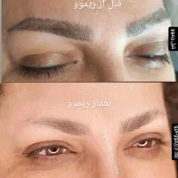 تخفیفات یلدایی ریموو تاتو /آرایش دائم|خدمات آرایشگری و زیبایی|سمنان, |دیوار