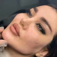 جشنواره زیبایی((مدل ژل وبوتاکس))