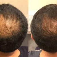 دنبال رویش و پر پشتی من کمکت میکنم