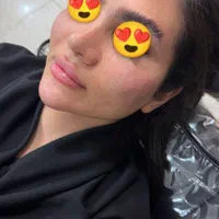 جشنواره تزریق ژل و بوتاکس خانم ها و آقایان