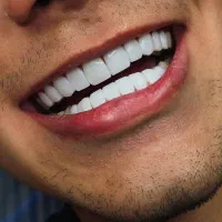 دندانپزشکی باتعرفه دولتی عصب‌کشی کامپوزیت|خدمات آرایشگری و زیبایی|تهران, تهرانپارس غربی|دیوار