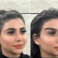 لیفت ابرو پکیج مادلینگ ژل لب بوتاکس فیلر بادی بینی|خدمات آرایشگری و زیبایی|اصفهان, سپاهان‌شهر|دیوار