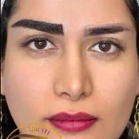 کاشت ابرو به روش futو میکرو کاشت|خدمات آرایشگری و زیبایی|اهواز, زیتون کارمندی|دیوار