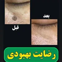 درمان|آرایشی، بهداشتی، درمانی|فیروزآباد (لرستان), |دیوار