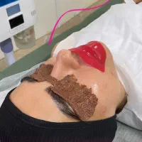 پاکسازی پوست تخصصی درمان پوست فیشال|خدمات آرایشگری و زیبایی|مشهد, توس (بلوار توس)|دیوار