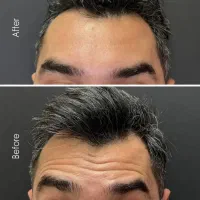 کلینیک زیبایی تزریق فیلر و بوتاکس و جوانسازی