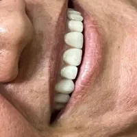 جشنواره کامپوزیت واحدی 1500ت با طرح طلابی شو|خدمات آرایشگری و زیبایی|گرگان, |دیوار