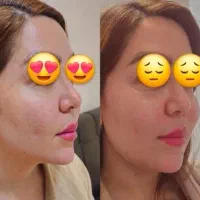 لیدر زیبایی ژل و بوتاکس و کاشت مو