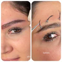 کلینیک کاشت ابرو ، میکرو کاشت ابرو ۱۳،۹۰۰