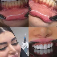 دندان کامپوزیت دندانپزشکی باهوش مصنوعی|خدمات آرایشگری و زیبایی|مشهد, دانشجو|دیوار