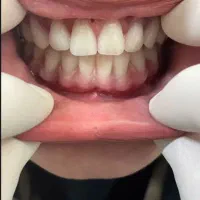 ساخت دندان مصنوعی اقساطی با بهترین کیفیت