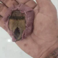 انگشتر|کلکسیون اشیاء عتیقه|شیروان (خراسان), |دیوار