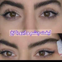 ژل و بوتاکس و مزو ژل|خدمات آرایشگری و زیبایی|بومهن, |دیوار