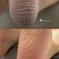 پدیکور پا