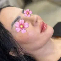 آفر ویژه فیلر بوتاکس مزوژل جوانساز آبدانان