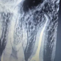 خدمات دندانپزشکی (تعرفه مناسب)