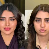 جشنواره واقعی کلینیک پوست نخ هایفو آموزش ژل بوتاکس|خدمات آرایشگری و زیبایی|تهران, زعفرانیه|دیوار